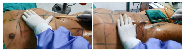 Illustration anatomique ou technique extraite de la thèse