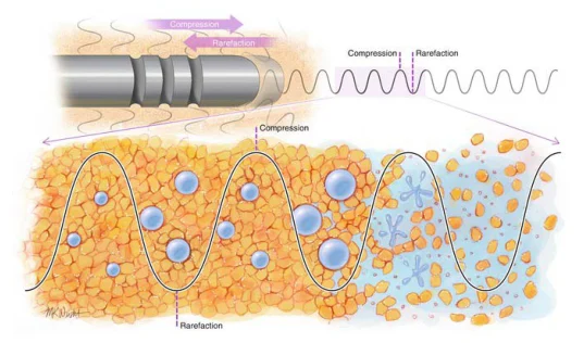 Illustration anatomique ou technique extraite de la thèse