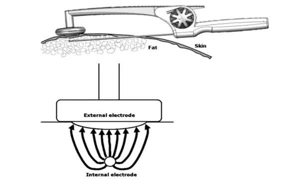 Illustration anatomique ou technique extraite de la thèse