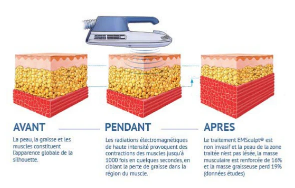 Illustration anatomique ou technique extraite de la thèse