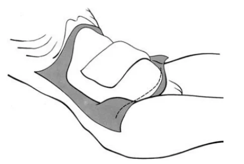 Illustration anatomique ou technique extraite de la thèse